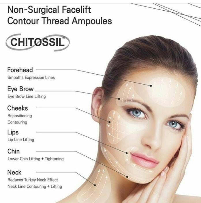 ESTHEPRO CHITOSSIL Thread Lift AMPOULE 521 Lifting & Rejuvenating Solution